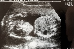 Photo1